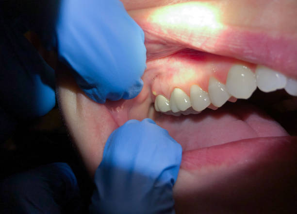 Best Tooth Infection Emergency Dentist  in Green Village, NJ